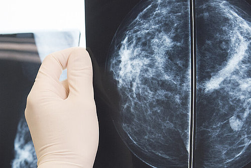 Ärztin betrachtet Brust-Ultraschallbilder