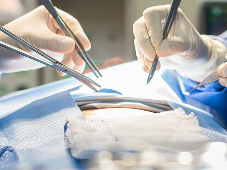 Ärzte operierern in gefäßchirurgischer Operation