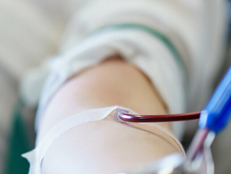Patientin bekommt Bluttransfusion