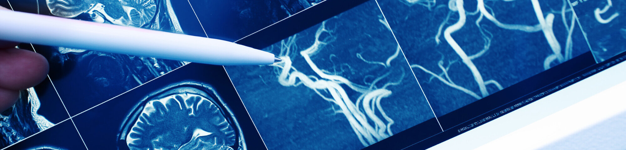 Ärzte besprechen MRT-Bilder von Blutgefäßen